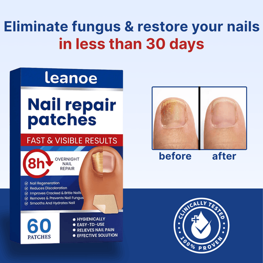 Antifungal nail patches